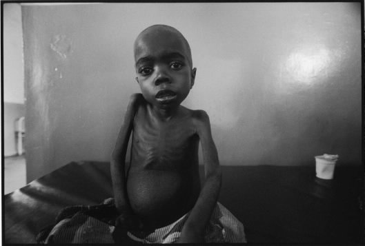 img3 A Congolese child suffering from malnutrition waits to die in a clinic in North Kivu, DRC. Such images are perpetually used to provoke western media spectators to donate to corporate relief operations. Photo Keith Harmon Snow, 2005.