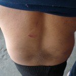 His back was kicked.